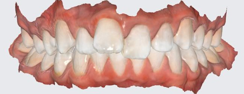 Patient3_Before2